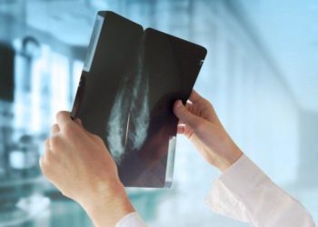 ABD’li bilim insanları: Meme kanseri riskini beş yıl önceden tespit edebiliyoruz