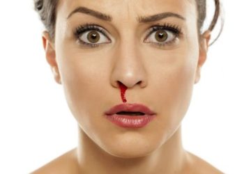 Epistaksis (Burun Kanaması) nedir? Nedenleri, tedavi yöntemleri…