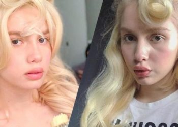 Kadınlarda estetik yaşı 18’e düştü