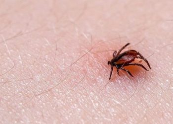 Lyme hastalığı için hangi bölüme/doktora gidilir?