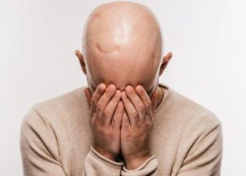 Saç, kaş, kirpik yolma hastalığı ve tedavisi…