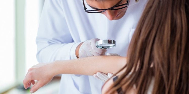 Balık pulu hastalığı neden olur, tedavisi var mı?