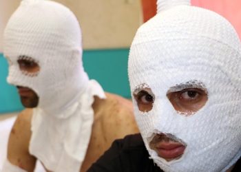 Biri çakmak doldururken öbürü sigara yaktı…