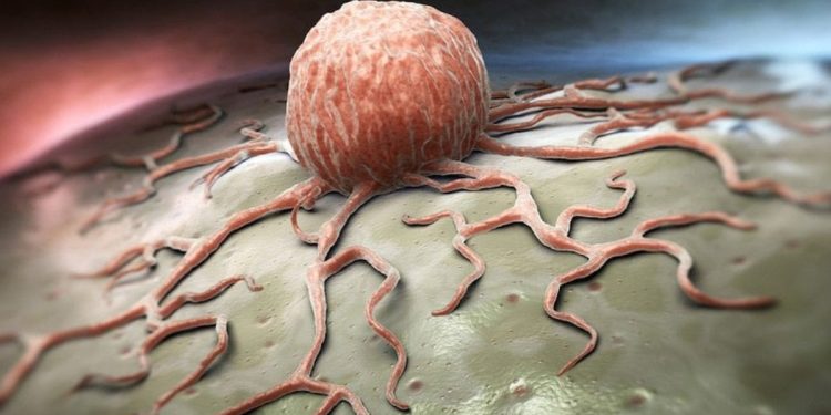 Günde 4,5 dakikayla kanser riskinizi azaltabilirsiniz